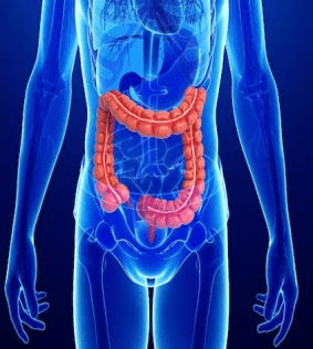 Crohn Hastalığı Nedir