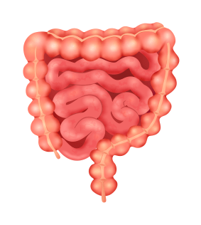 ülseratif kolit nedir